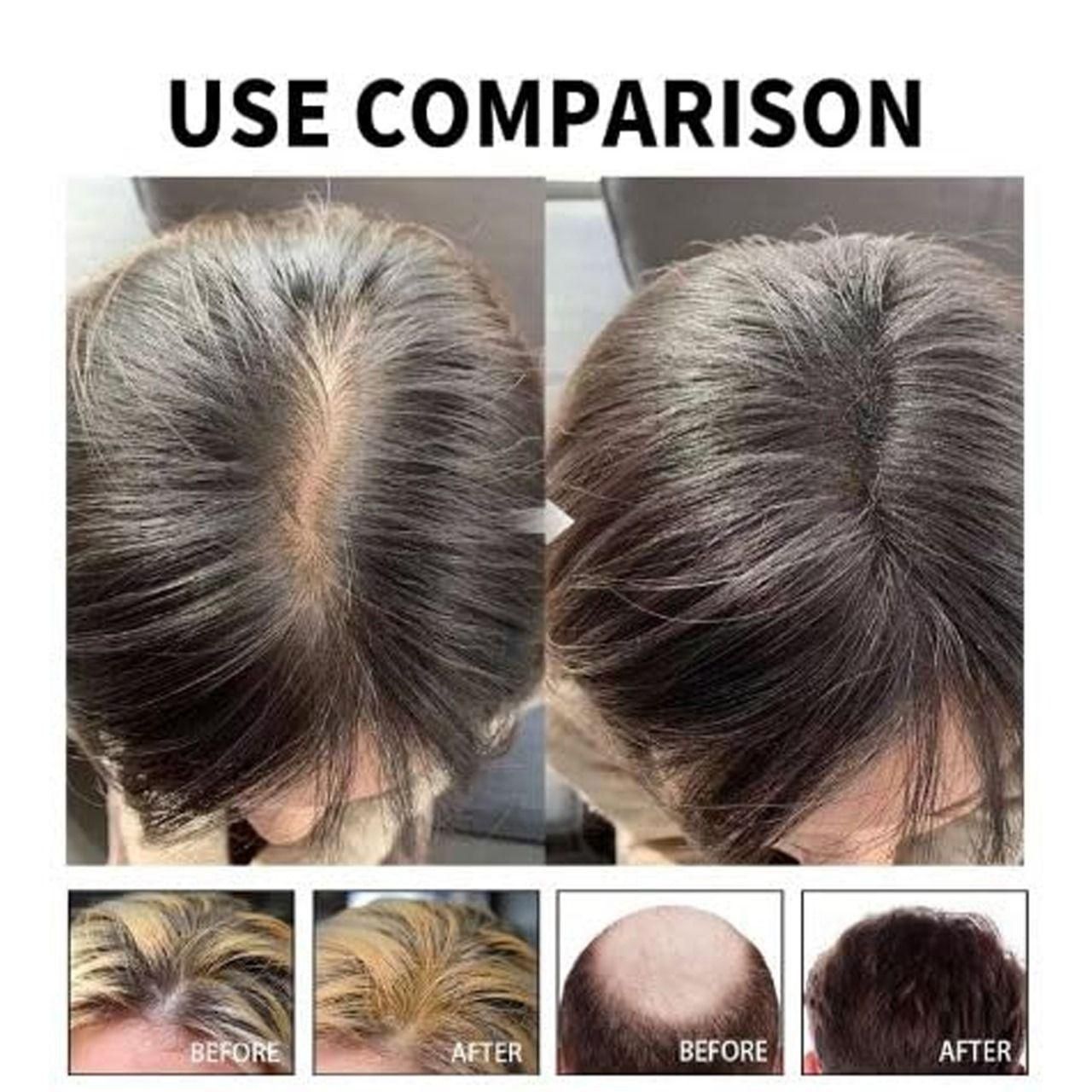 Authentic Ayurvedic Hair Wellness Serum 30ml - Natural Hair Nourishment Pack of 2 | Blueberry Botanicals